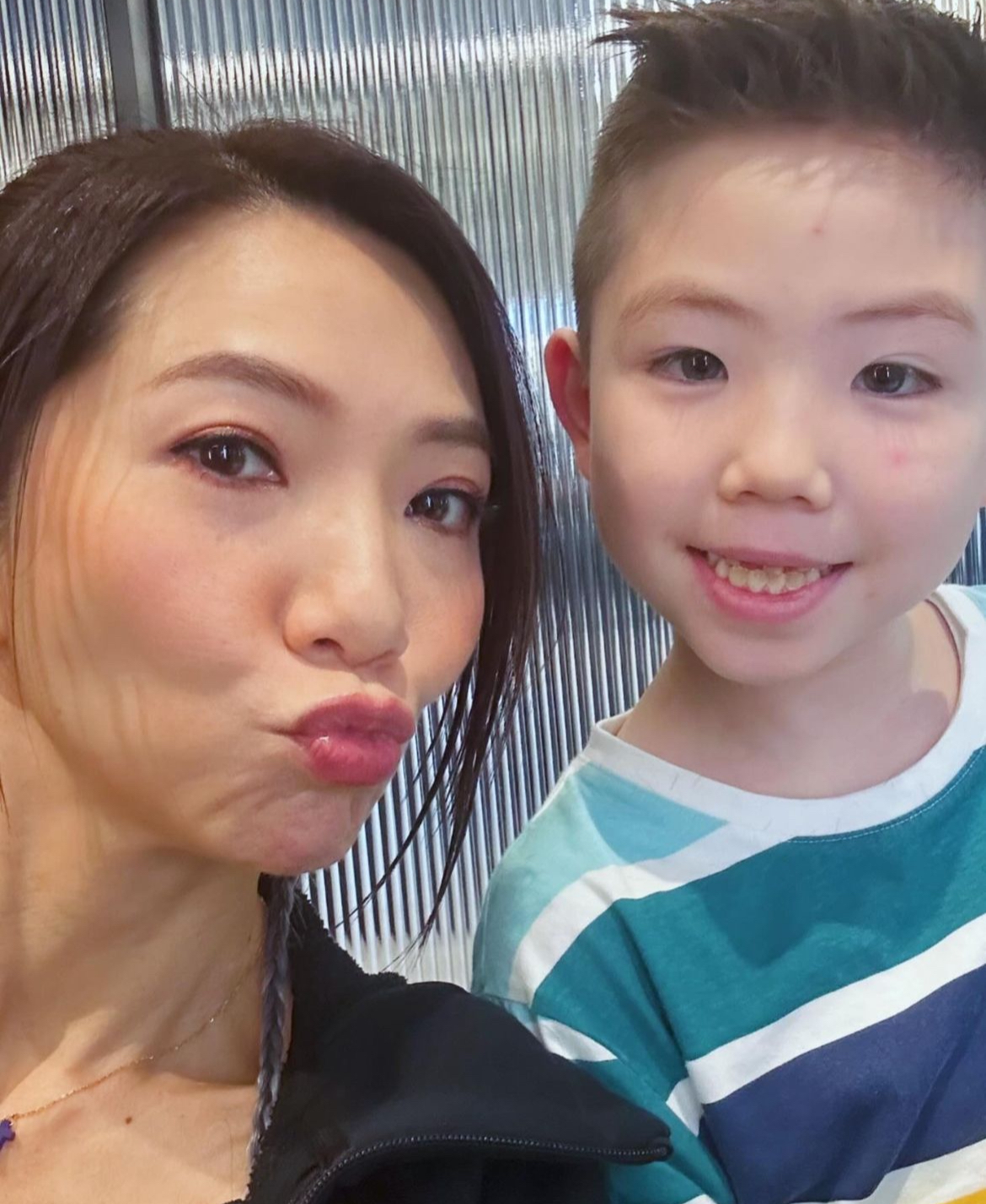 車婉婉的兒子BBQ最近接受倒及牙治療。（圖片來源：Intagram@chenyuenyuen1228）