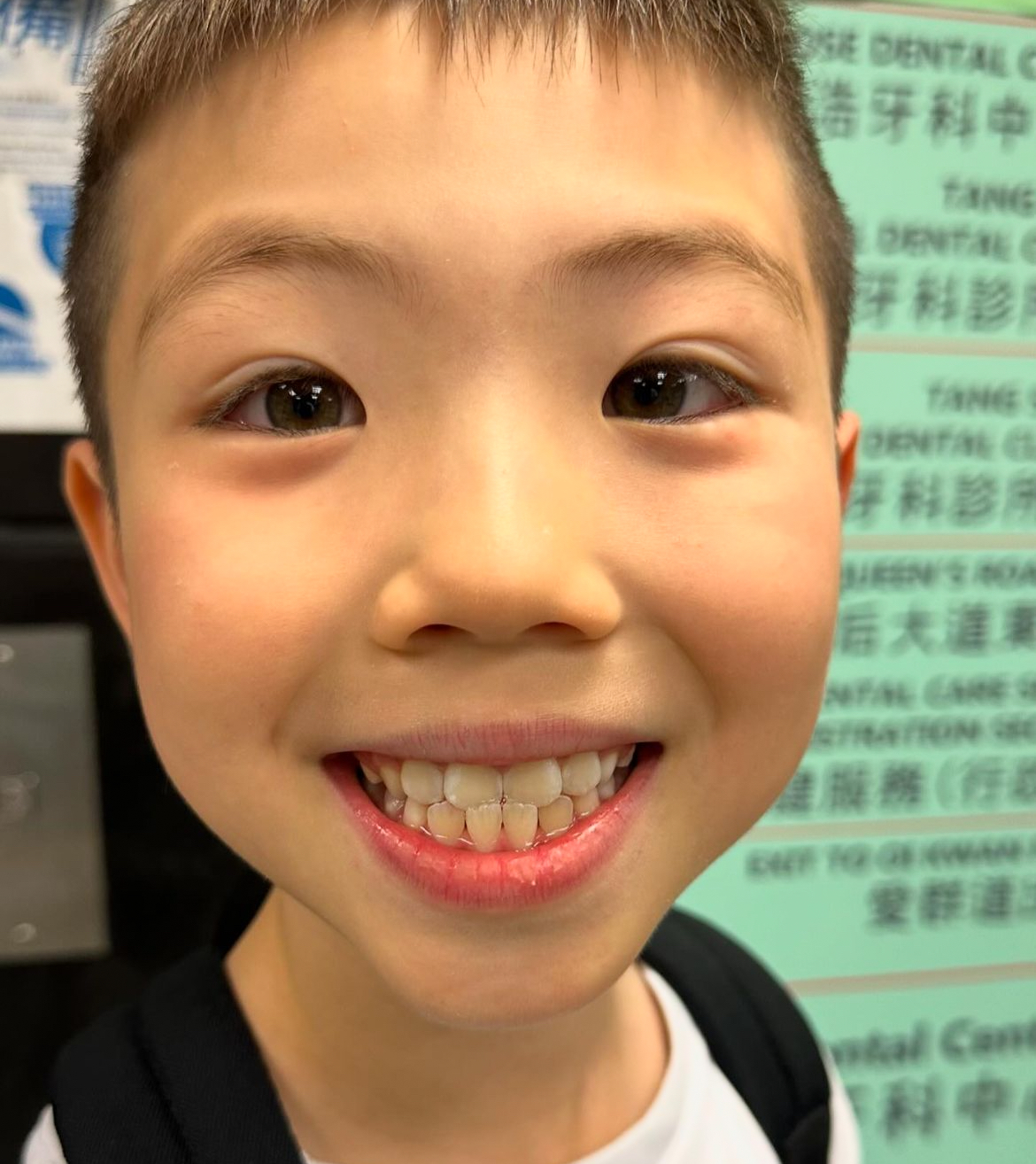 車婉婉兒子在牙科保健時發現倒及牙情況。（圖片來源：Intagram@chenyuenyuen1228）