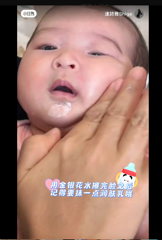 BB 胎毒 紅疹 懷孕 連詩雅 金銀花水