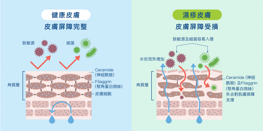 家居環境-濕疹-兒科-周博裕