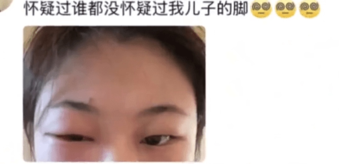 聞BB腳