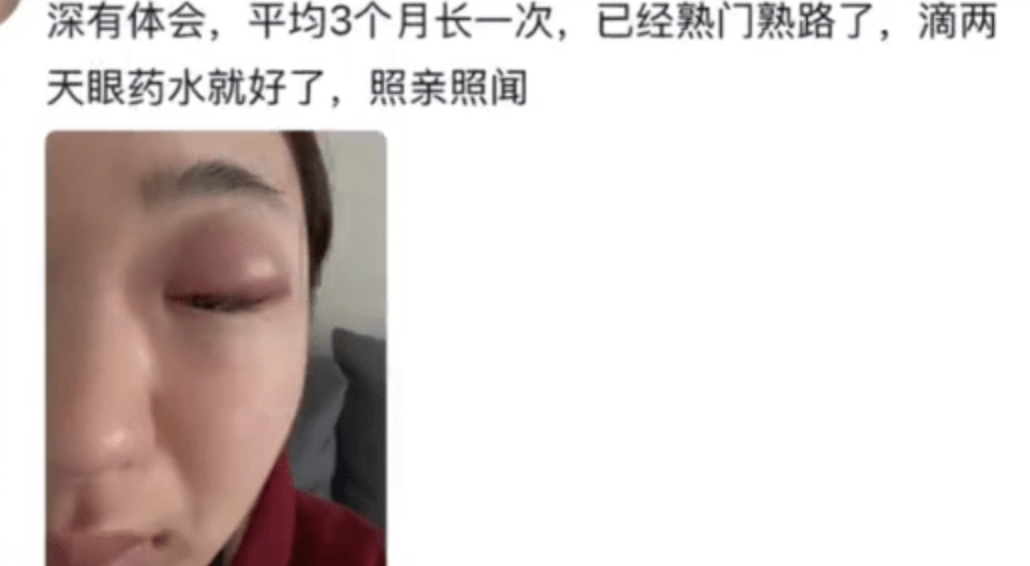 聞BB腳