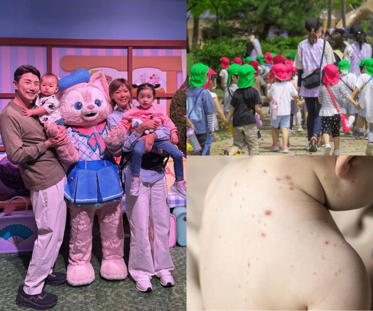 梁諾妍「2個女輪流係咁病」大女患手足口病嘆嚴重可致生命危險？認識幼兒6大傳染病
