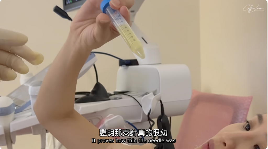 林芊妤 Coffee 遺傳病 染色體 羊水穿刺 懷孕 產前