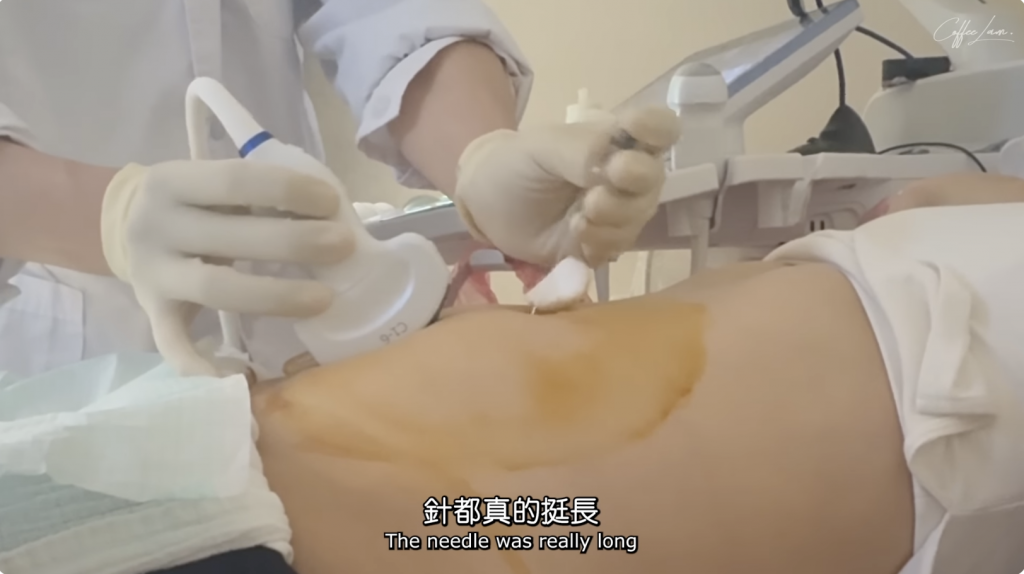 林芊妤 Coffee 遺傳病 染色體 羊水穿刺 懷孕 產前