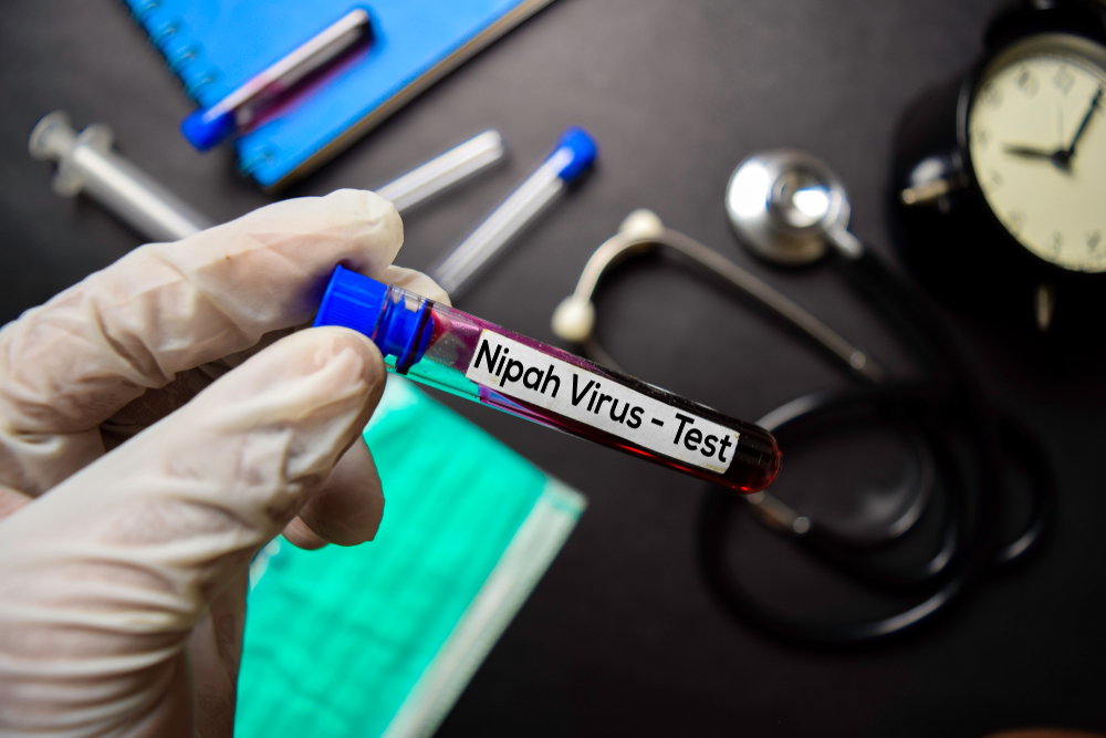 Nipah,Virus