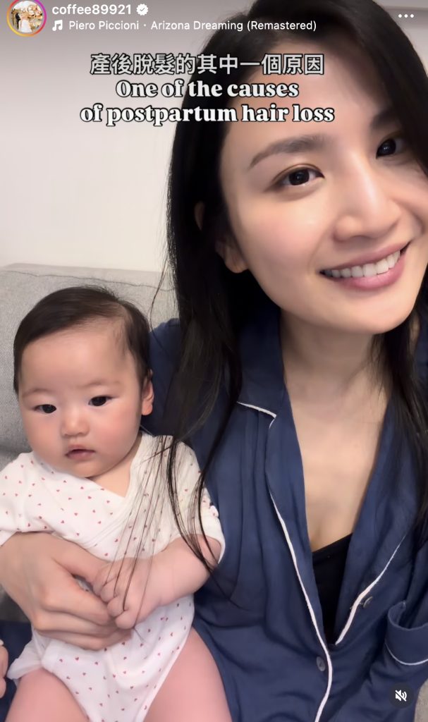 Coffee 林芊妤 產後脫髮 產後