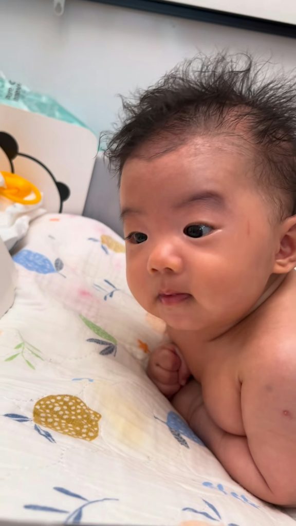 張寶兒 袁偉豪 胎痣 BB胎記