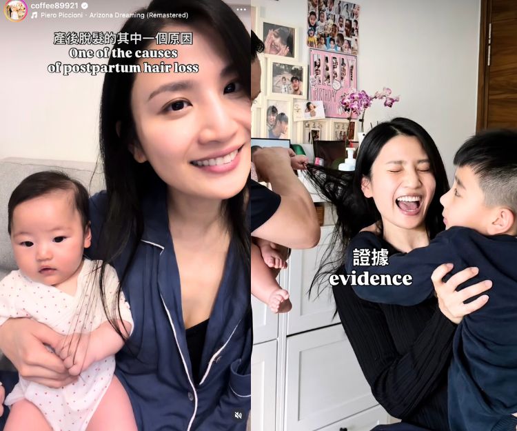 產後脫髮｜Coffee林芊妤公開「脫髮」真相？中醫拆解3成婦女中招原因：必試生髮食療！編輯推介4款防脫髮好物